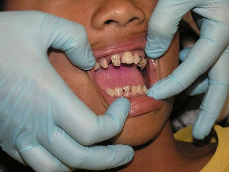 zobozdravstvo